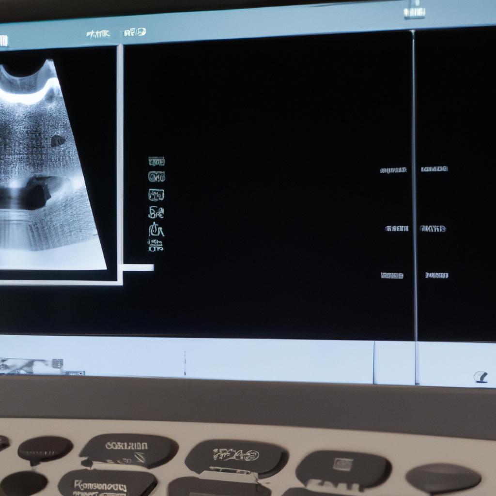急性腰痛を超音波治療で迅速に解消！
