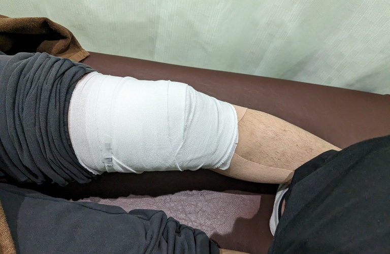 捻挫からのスポーツ復帰を徹底サポート！