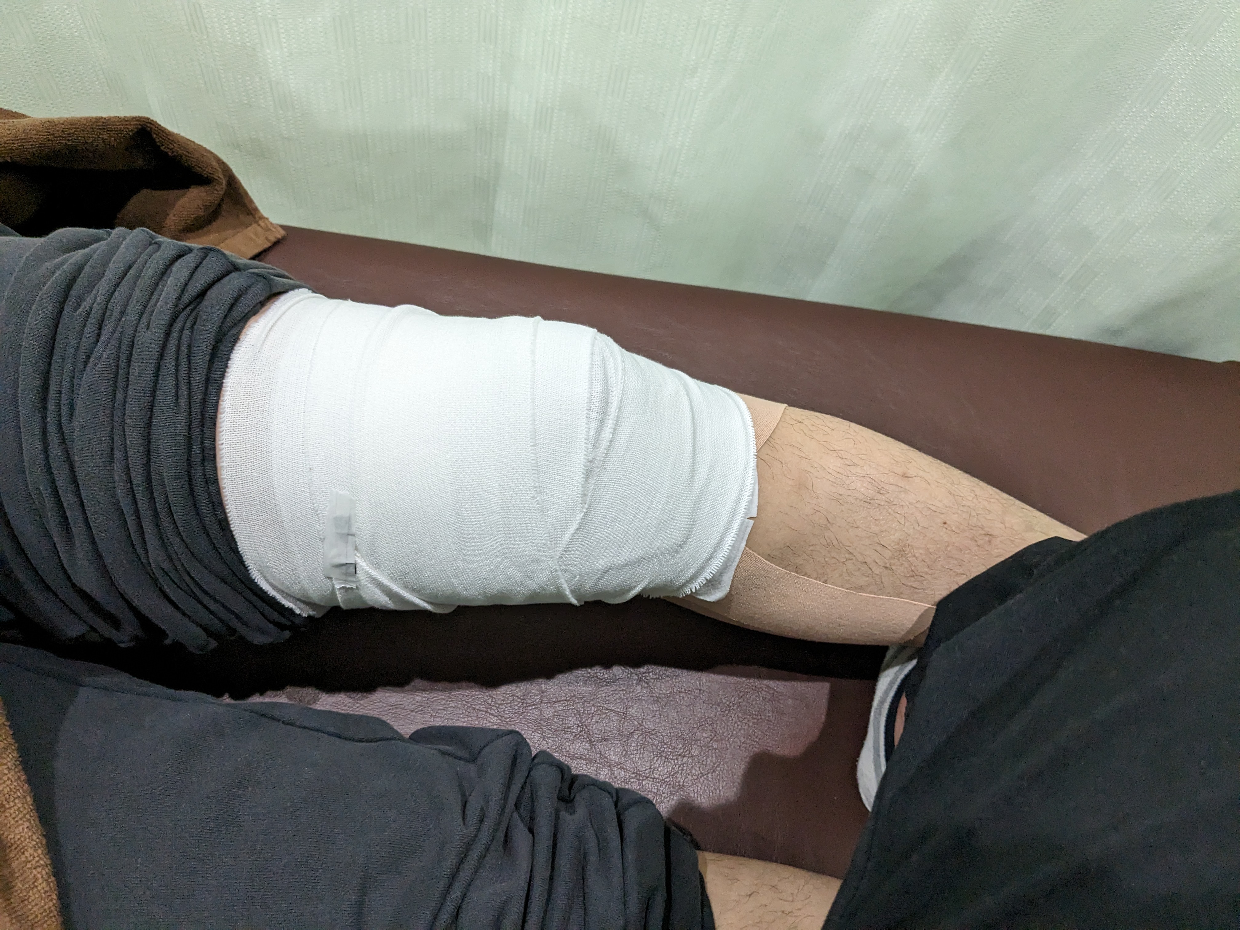 捻挫からのスポーツ復帰を徹底サポート！