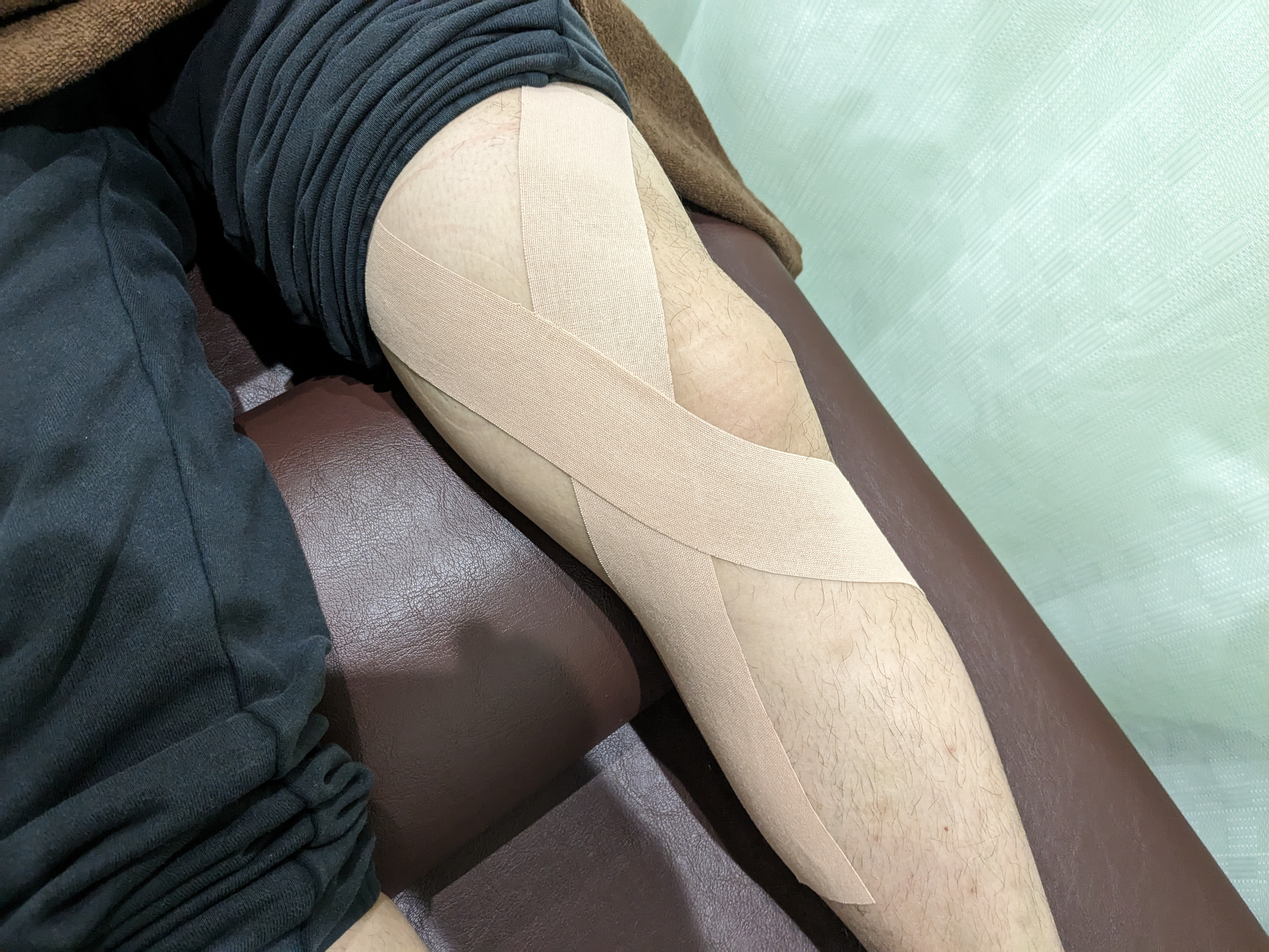 身体の歪みと膝関節症