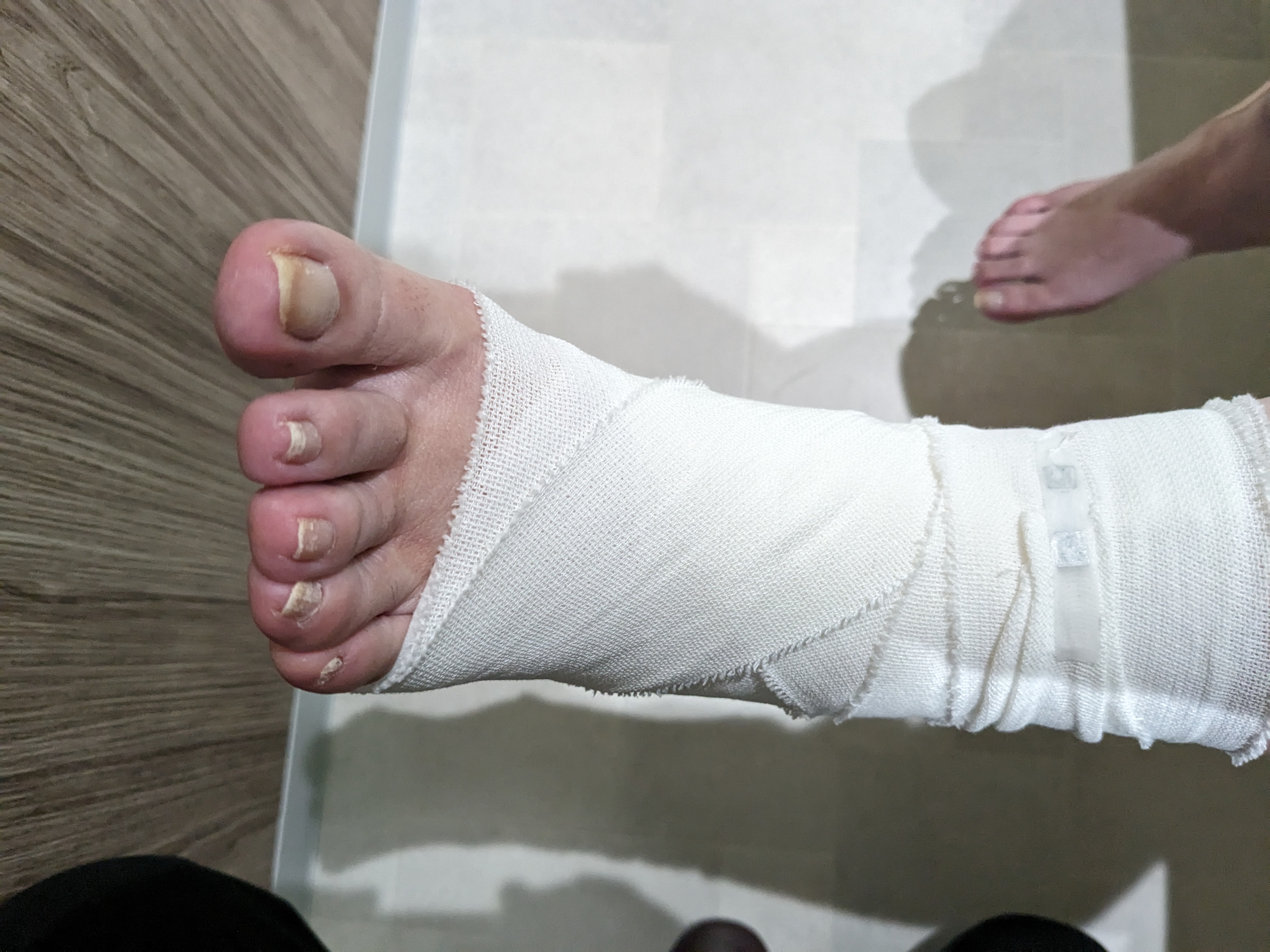 関節捻挫の予防方法