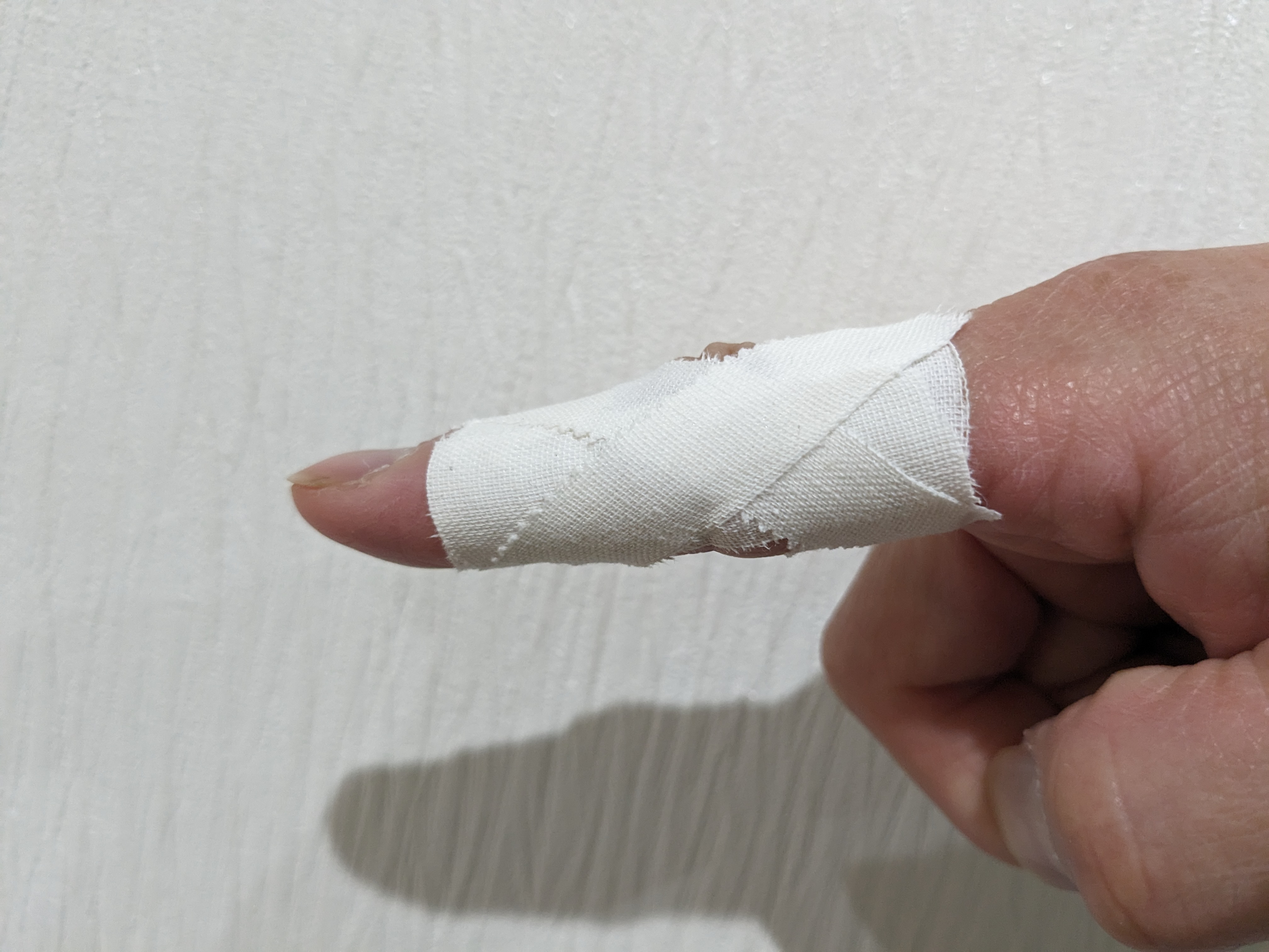 ストレスと指の痛みの関係