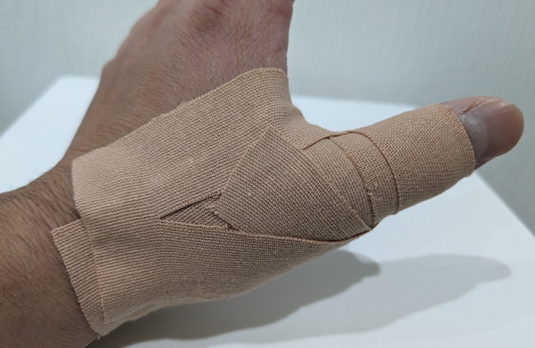 腱鞘炎のリハビリテーションの専門家に相談しましょう！
